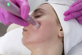 woman-receiving-microneedling-facial-treatment-.jpg Woman receiving microneedling facial treatment.